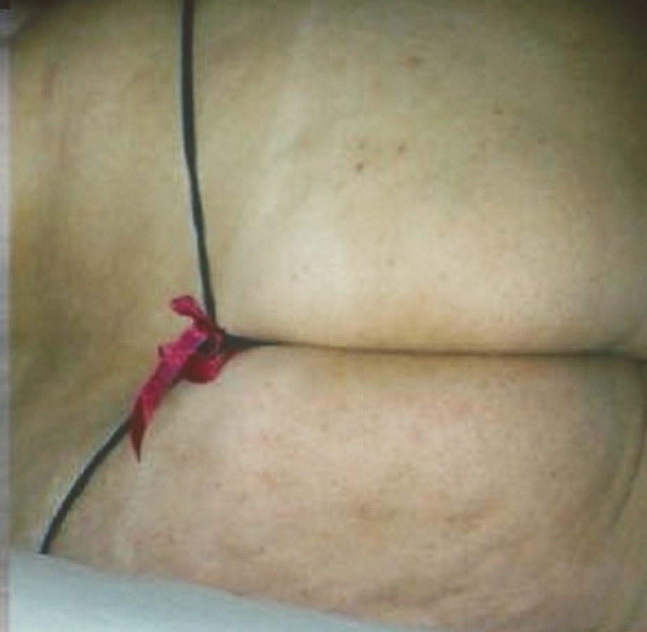 teenies und milfs — 5